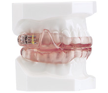 Oral appliance on smile mmodel