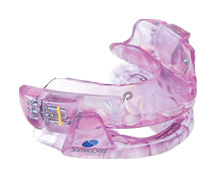 Custom sleep apnea appliance