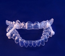 clear oral appliance