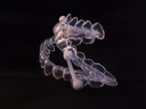 oral appliance for sleep apnea in Columbus